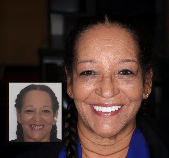 Roberta testimonial transformation