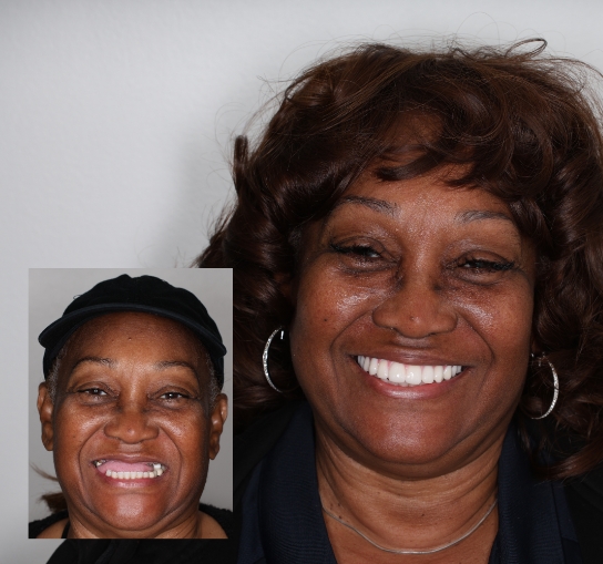 Ruth testimonial transformation